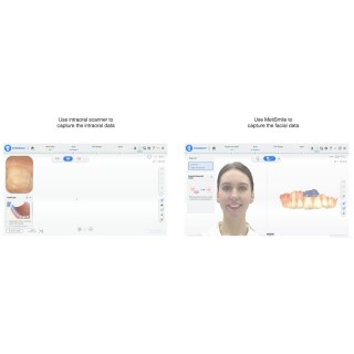 Shining 3D Dental Scanner Metismile Face Facial Data Ortho Simulation